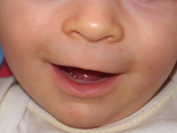 first teeth appearing!