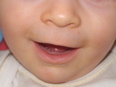 first teeth appearing!