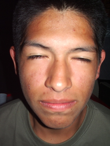 Antoine